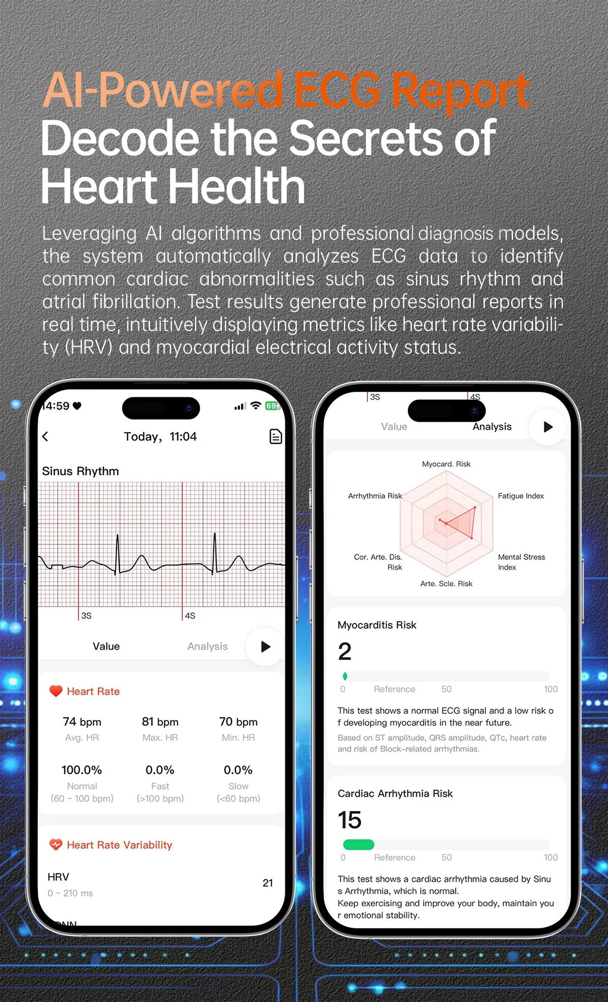 2025 New Health Analysis ECG+PPG Smart Watch Body Fat Uric Acid Blood Pressure Heart Rate Tracker NFC Smartwatch For Android IOS