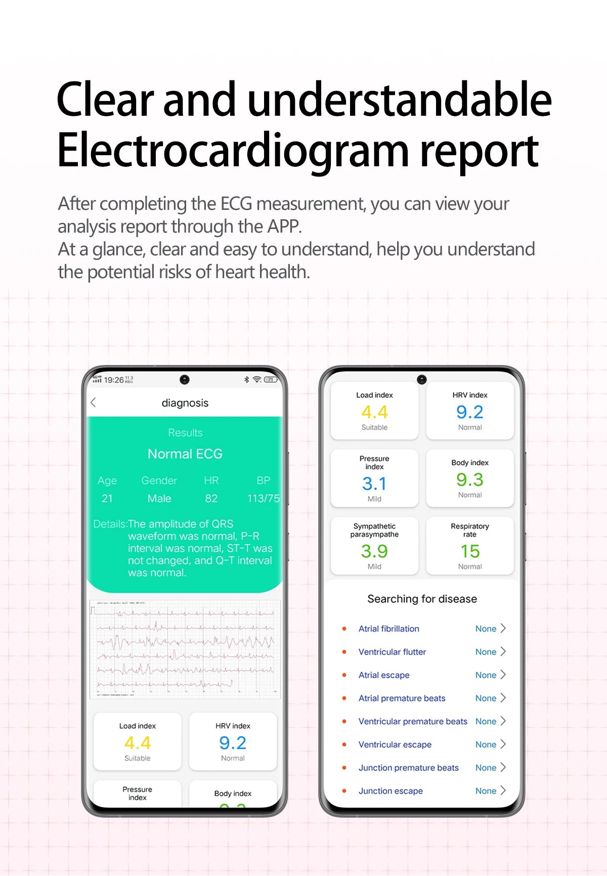 2025 AI Diagosis ECG Health Smart Watch Men Blood Pressure Lipid Uric Acid NFC Air Pump Airbag Health Smartwatches Women For IOS